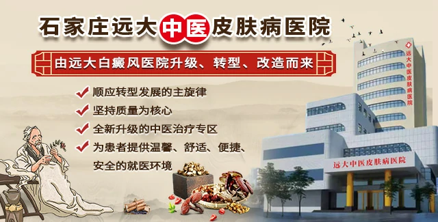 石家庄治疗皮肤病最好的医院