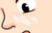 白斑治疗中