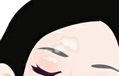 背部白癜风治疗中